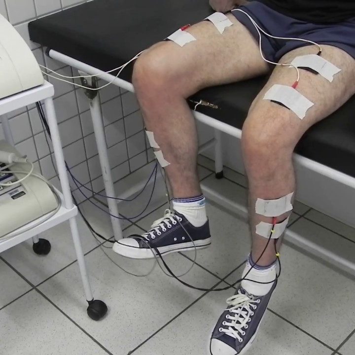 eletroestimulacao avc- RedEficiente